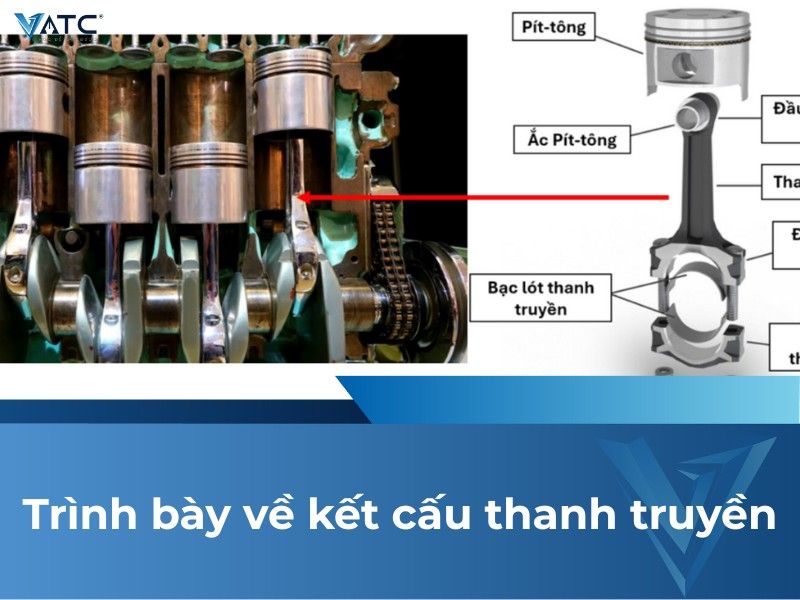 Trình bày về kết cấu thanh truyền